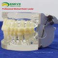 DENTAL12(12572) Transparent Jaw Model with Teeth for Self Brushing Educaion